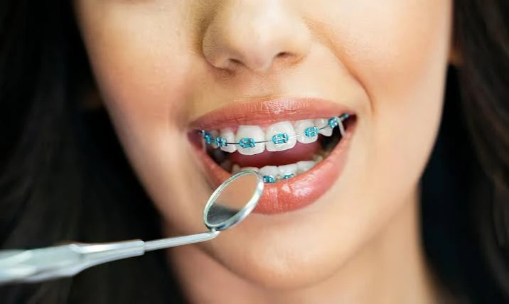 Examination of teeth with metal braces