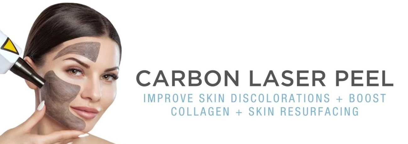 Carbon laser peel treatment banner