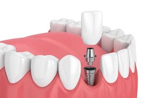 Dental care at Dermadent